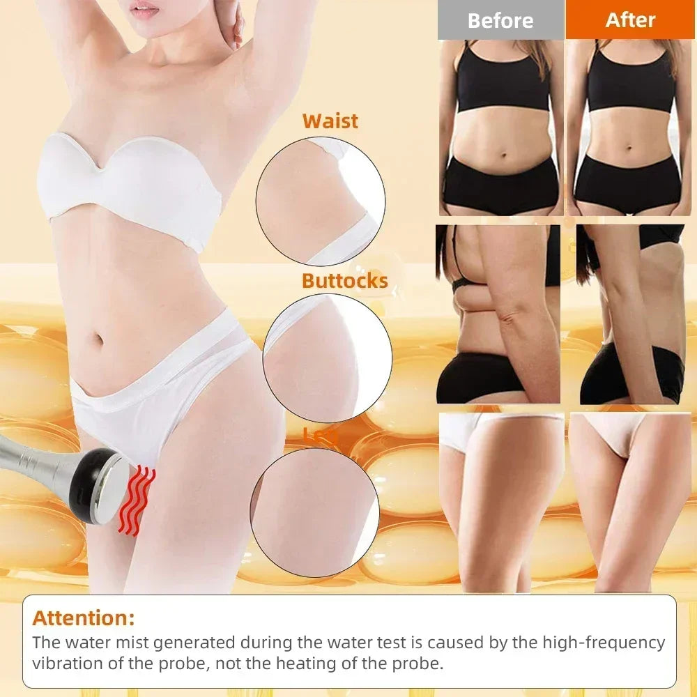 Missheart 4in1 Cavitation Ultrasonic Body Slimming Machine